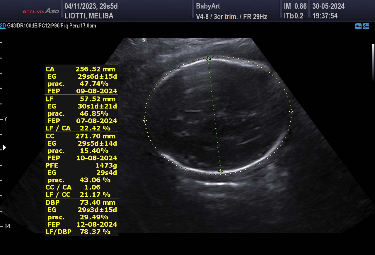 JULIA DE MELISA LIOTTI_0009.JPG